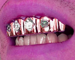 Iced Out Grillz: WILD Bling for Your MOUTH!