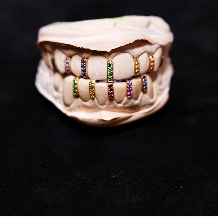 Iced out grillz