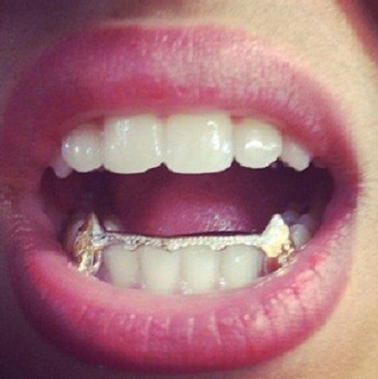 Iced out grillz