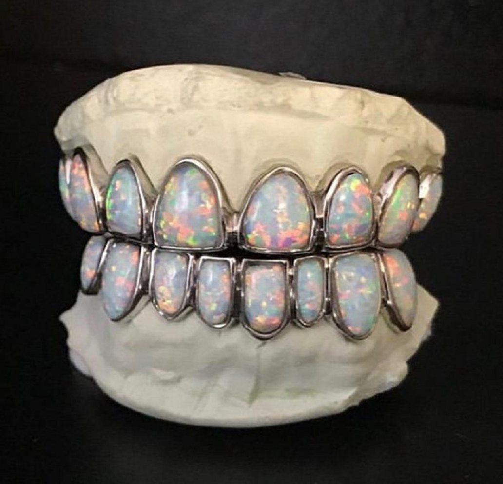 Best bling grillz 2021 Opal Gemstone Blinged-Out Grillz