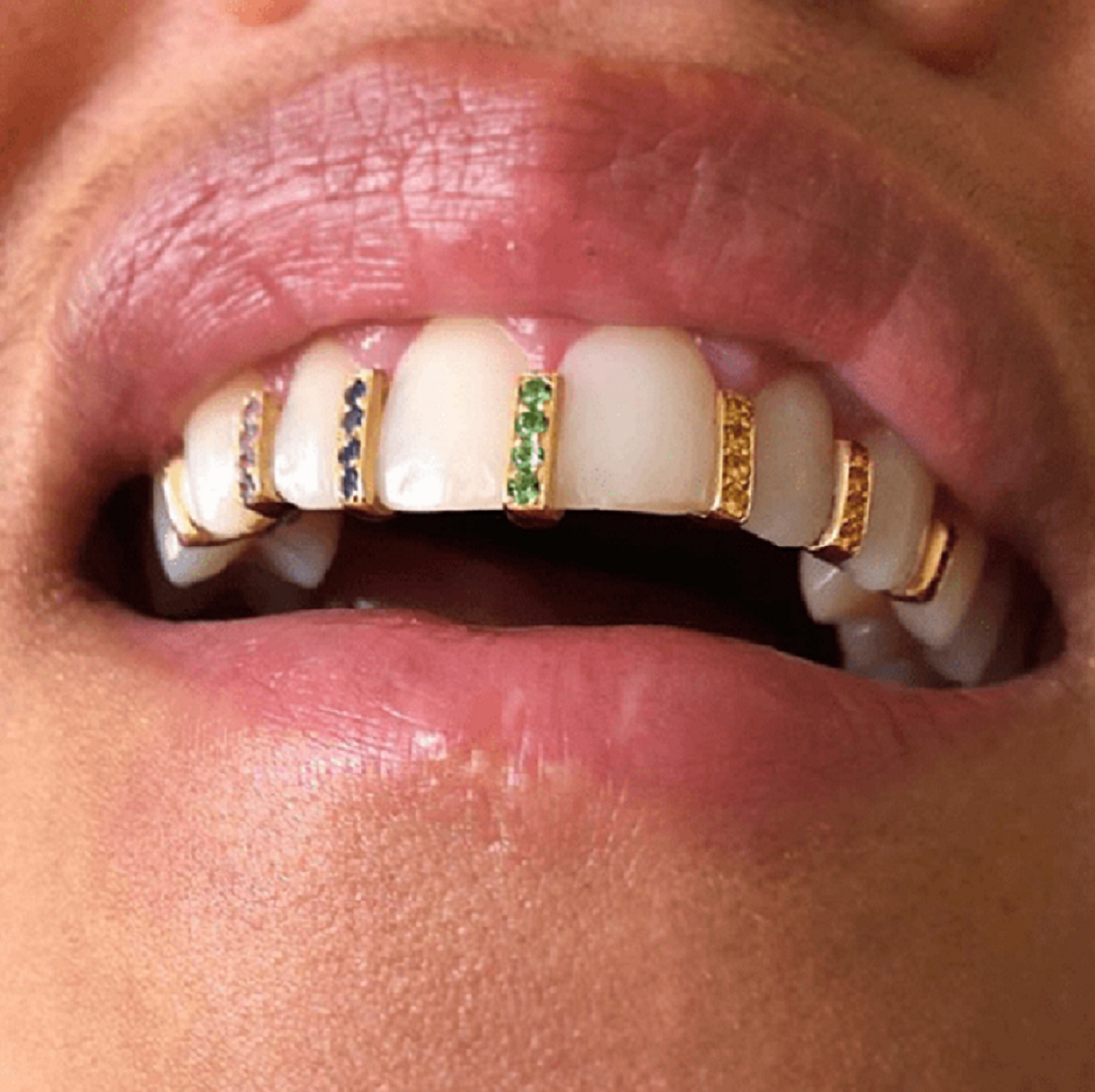 Blinged-Out Gold Platted Grillz with Glittering Rhinestones