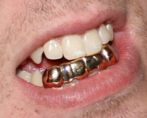 Best Bling Grillz on Amazon