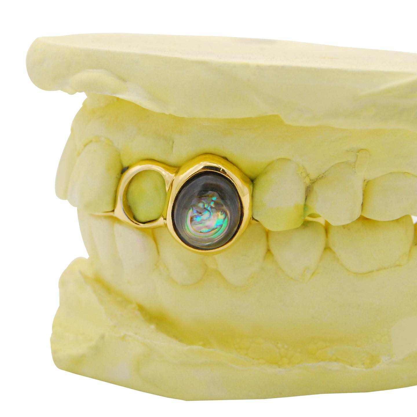 Yellow Gold Two Teeth Grillz with Black Opal Stone